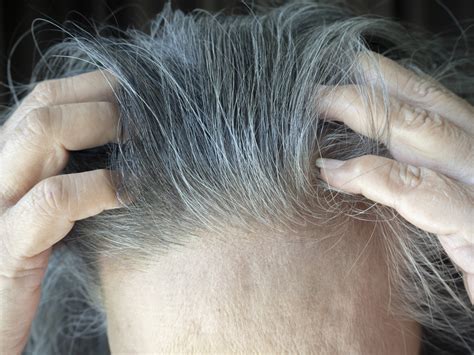 This tapered hair technique actually hides thinning spots fast 9