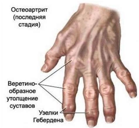 Кольца на пальцах | Здоровое питание