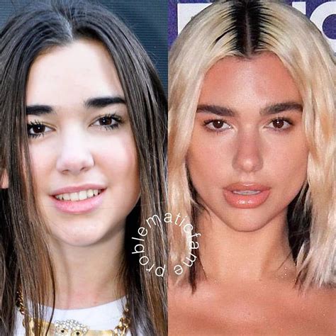 Dua Lipa is one of the prettiest pop girls of all time - Page 2 - Base ...