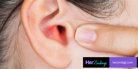 Symptoms And Home Treatment For Boil In Ear-कान में फुंसी निकल आए तो अपनाएं ये उपाय