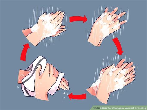 how often to change wound dressing