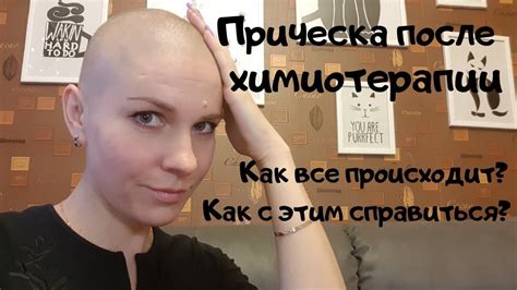 Прическа после химиотерапии. Когда волосы начинают выпадать? - YouTube