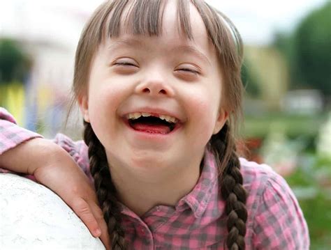 Pessoas Com Sindrome De Dow - Cid Sindrome De Down - RETOEDU