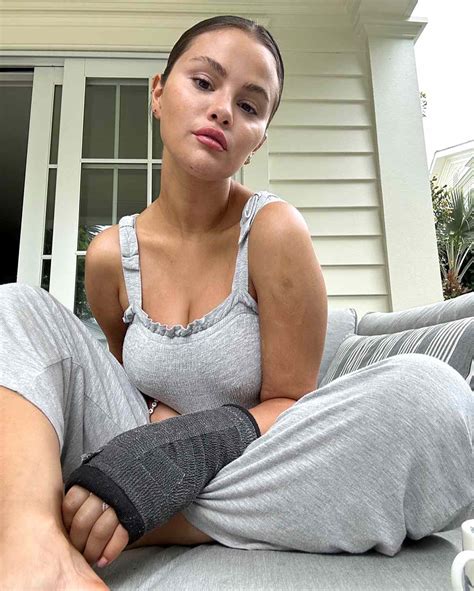 Broken Hand Cast