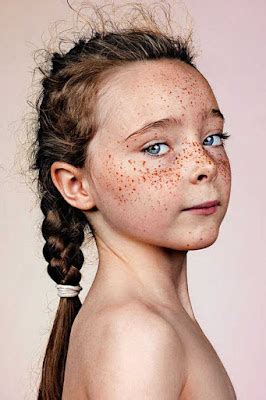 gather: Freckles