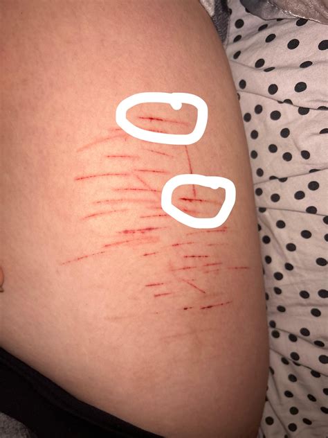 This One MyHealth Atrius Health Trick Saved My Life (You Won't Believe It!) Image 18