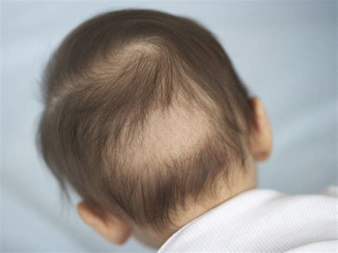 Cabelo Do Bebe Caindo Com 3 Meses - O bebê de 3 meses | BabyCenter