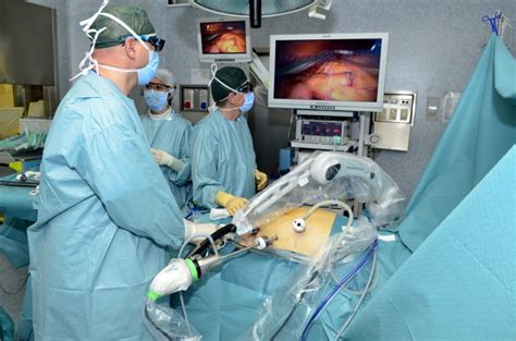 Какво представлява лапароскопска хирургия — Medconsult.bg