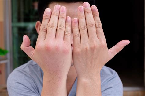 Опухли суставы пальцев рук. Как лечить? - ExpertNeuro