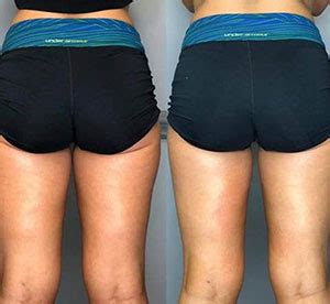 Before and After Photos of Clients in Northridge, CA
