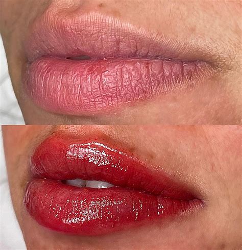 O Que É Micropigmentação Labial - Micropigmentação labial: Como é feito e o Antes e depois – Tá Chique