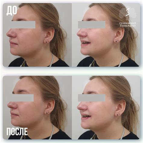 Ортогнатические операции в Москве на базе Сеченовского Университета