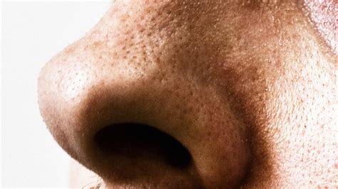 How To Get Rid Of Your Big Nose In Selfies