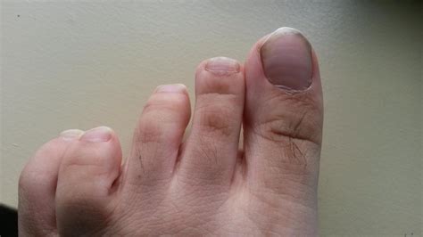 Are these Beau's lines? They weren't there the last time I clipped my