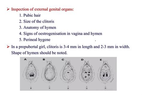 Pediatric and adolescent gynecology koc univ. web | PPTX