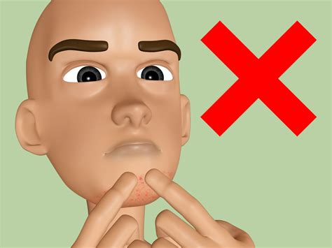 how to stop razor bumps 4