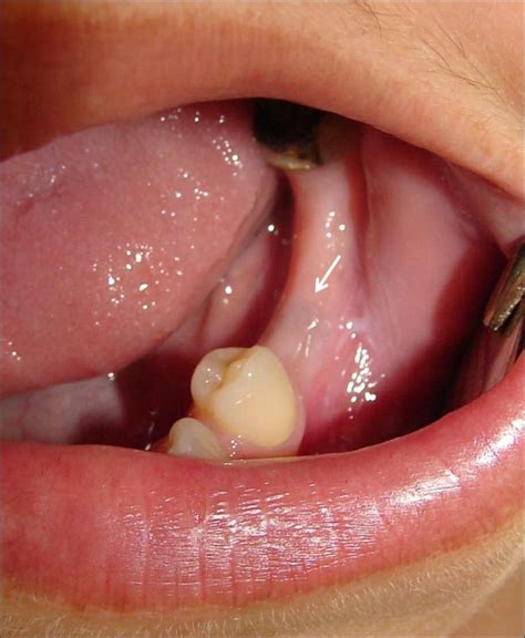 dysesthesia  nerve damage  harrison grove blog