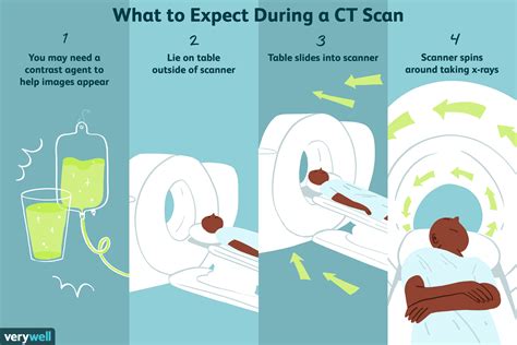 CT (Computed Tomography) Scan: Procedure and Results