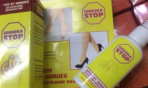Мазь от шишек на ногах: чем мазать косточку на большом пальце