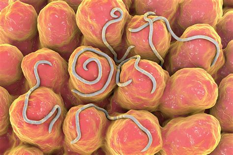 Threadworms In The Gut Photograph by Kateryna Kon/science Photo Library ...