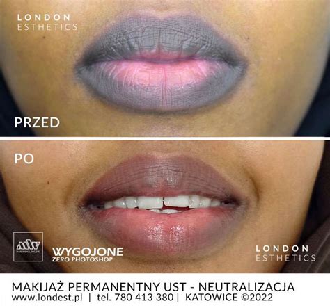 Makijaż permanentny ust i kolory dla Twojej skóry | LONDON ESTHETICS