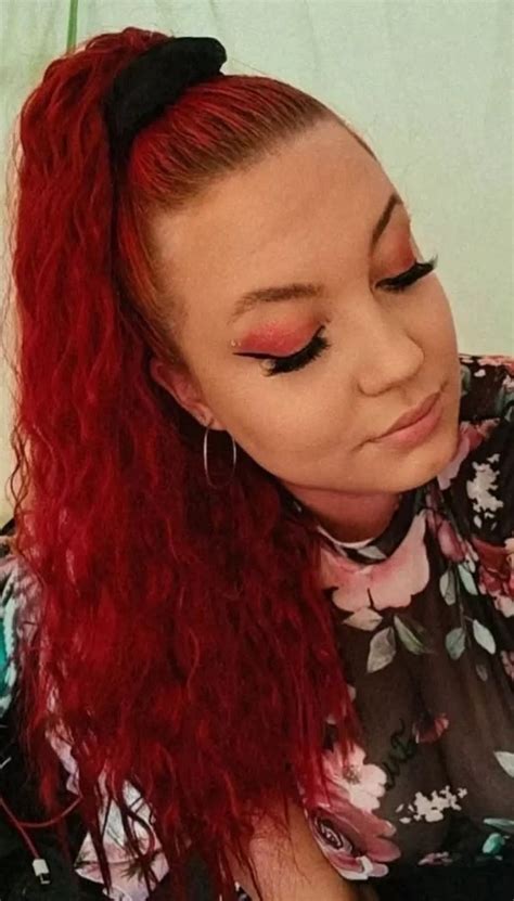 Woman thought it was normal to be bloated all the time - until she fell