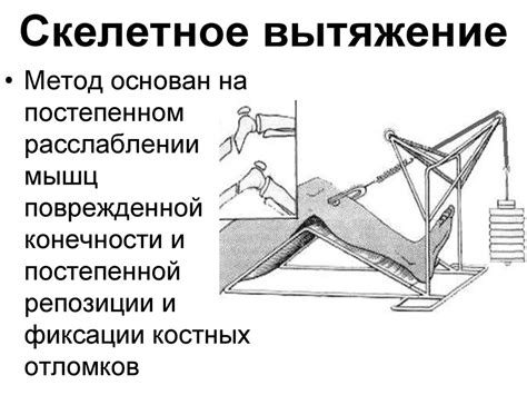 Основы травматологии. Переломы костей. Вывихи - презентация онлайн
