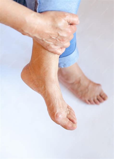 Premium Photo | A painful swelling on the first joint of the big toe