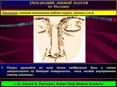 Операции на мозговом отделе головы - презентация онлайн