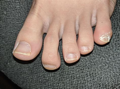 What Should My Toenails Look Like at Don Kimber blog