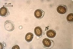 Parasitology Lab 1 Test Pics | Quizlet