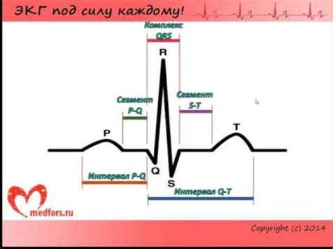 Урок 2. Видеокурс "ЭКГ под силу каждому". - YouTube