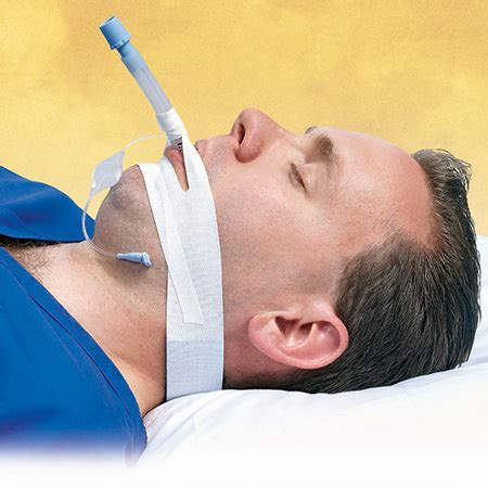 Endotracheal Tube Securing Tape, TrachTape, Cloth, Adhesive, PadLoc ...
