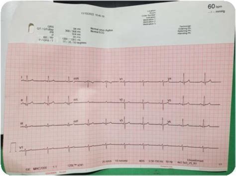 GE MAC 2000 EKG Machine 12 Lead Resting ECG System w/ WiFi - Patient ...