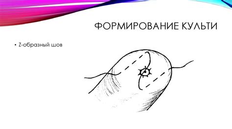Кишечные швы - презентация онлайн