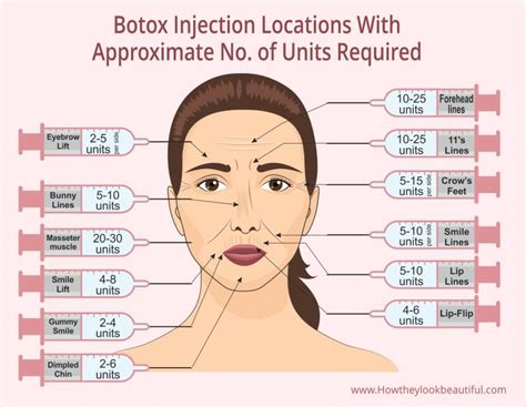 botox dermal filler training  certification detroit chinatown