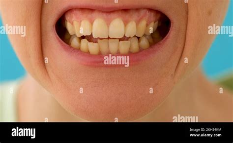 Grit your teeth Stock Videos & Footage - HD and 4K Video Clips - Alamy