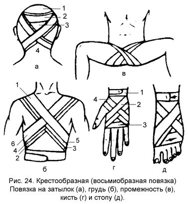 Повязки на нижние конечности