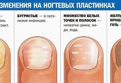 Деформация ногтей: причина, диагностика и лечение - Estet-Portal