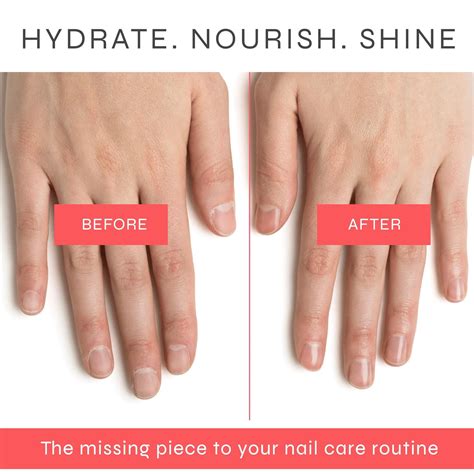Nourishing Cuticle Oil | Hydrated Cuticles & Healthy Nail Growth – Dr. Dana
