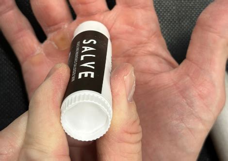 Mastering Callus Care: 3 Signs Your Calluses Need Attention – SandBar ...
