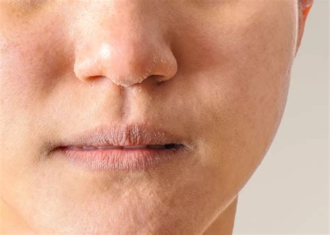 Skin Treatments For Dry & Sensitive Skin | R Clinic