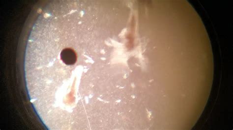 Рачки Артемии Под Микроскопом (Artemia Crustaceans Under The Microscope ...
