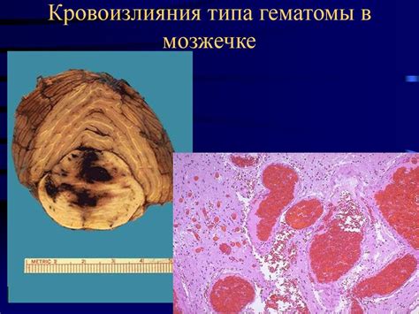Нарушения кровообращения и лимфообращения - презентация онлайн