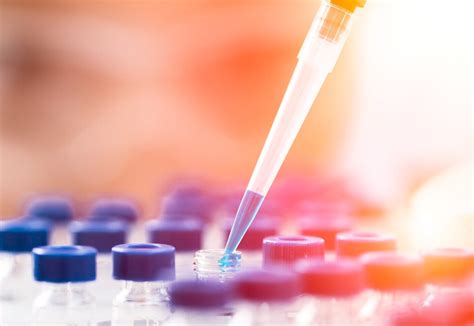 analytical research  development lead sciences