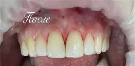 Стоматология New Smile - Записаться в стоматологию Киров