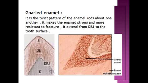 enamel structure - YouTube