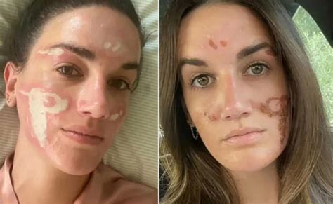 From Tears To Furor Alicia Bell Bares The Fire That Burned Her Name news