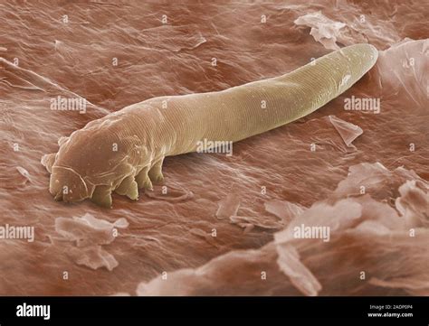 Eyelash mite. Coloured scanning electron micrograph (SEM) of an eyelash ...