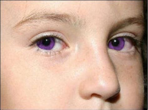 purple eyes | Rare eyes, Eye color facts, Violet eyes